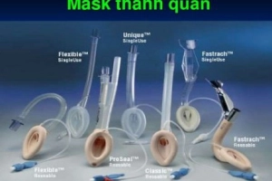 Gây mê mask thanh quản phẫu thuật áp xe dưới màng tủy