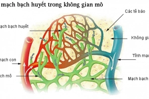 Giãn mạch bạch huyết tiên phát ở người lớn: trường hợp lâm sàng và tổng quan tài liệu