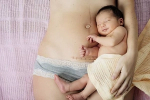 Hiểu đúng về giảm đau và chăm sóc sau sinh mổ
