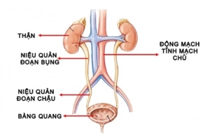 Hội chứng tiết dịch niệu đạo ở nam giới