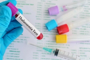 Hồng cầu nhỏ thì bệnh Thalassemia ở dạng biến thể nào?