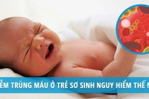 Hướng dẫn chăm sóc trẻ bị nhiễm trùng máu