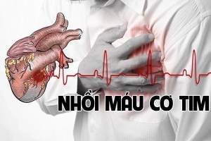 Huyết áp thấp gây bệnh nhồi máu cơ tim