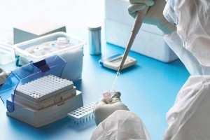 Kết quả test PCR CT 28 đã khỏi Covid chưa?
