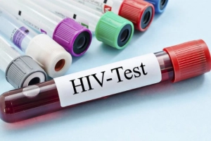 Kết quả xét nghiệm HIV như thế nào là nguy hiểm?