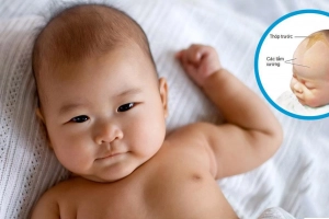 Khi nào cần khám thóp trẻ sơ sinh?