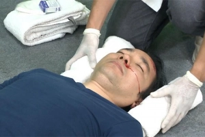 Không nhớ gì sau chấn thương sọ não có nguy hiểm không?