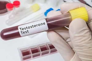 Làm sao để biết nồng độ testosterone của mình là bao nhiêu?