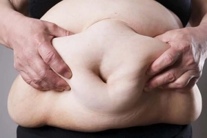 Liên quan giữa béo phì và bệnh tiểu đường type 2