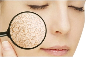 Lời khuyên hàng đầu của bác sĩ da liễu để làm giảm khô da