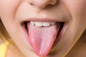 Lưỡi nói gì về sức khỏe của bạn?