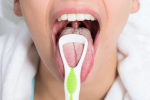 Lưỡi xuất hiện tua trắng kèm hơi thở hôi có phải nấm lưỡi không?