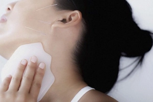 Mặt bị xệ sau điều trị liệt dây thần kinh số 7 phải làm sao?