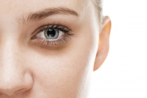 Mắt thâm quầng là biểu hiện của bệnh gì?