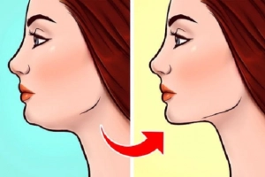 Mewing là gì và làm như thế nào?