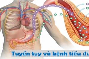 Mối liên hệ giữa bệnh đái tháo đường và tuyến tụy