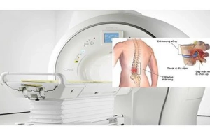 Nam giới chụp MRI lưng sau bao lâu chụp chân?