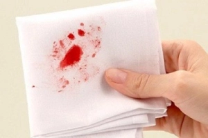 Nam giới khạc ra máu khi đánh răng nguyên nhân là gì?