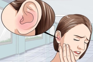 Nấm tai kèm ù tai phải làm sao?