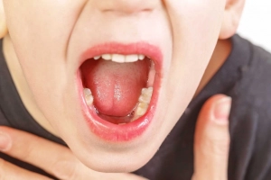 Nạo VA cho trẻ liệu có gây đau?