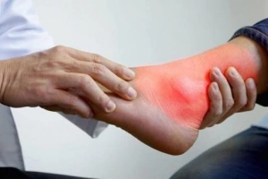Người bị bệnh gút có ăn được canh cua không?