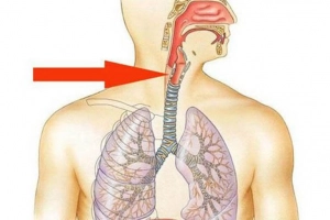 Người bị bỏng thực quản do xăng có thể để lại hậu quả gì?
