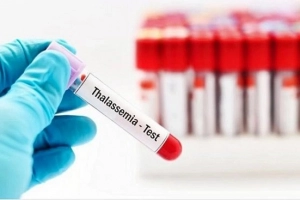 Người mang gen Thalassemia cần lưu ý gì?