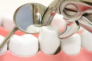 Người trưởng thành nhổ răng có giảm tuổi thọ không?