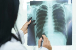 Nguyên nhân đáng ngạc nhiên của tổn thương phổi