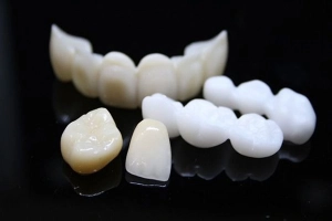 Nguyên nhân đổi màu răng sứ