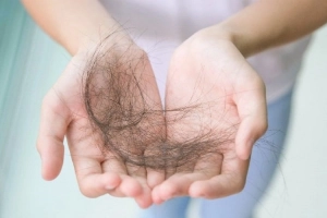 Nguyên nhân rụng tóc từng mảng là gì?