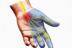Nguyên nhân, triệu chứng của bệnh thần kinh ngoại biên