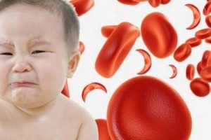 Nhận biết trẻ thiếu máu