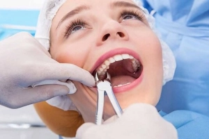 Nhổ răng đã lấy tủy có đau không?