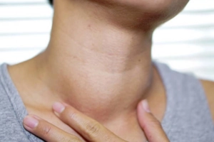 Những lưu ý sau khi mổ bướu cổ