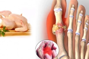 Những món ăn chữa bệnh gút