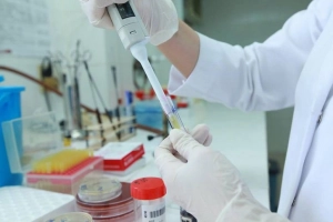 Nhuộm đờm tìm vi khuẩn Mycobacteria