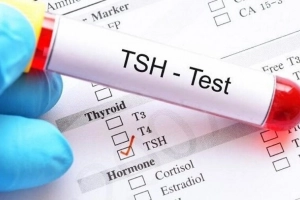 Nữ giới có chỉ số TSH 6.104 có nguy hiểm không?