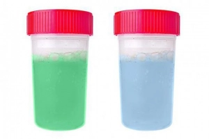 Nước tiểu màu xanh là bị bệnh gì?