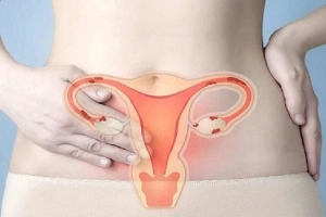 Pap smear, sinh thiết, CT, MRI trong chẩn đoán ung thư cổ tử cung