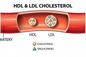 Phân biệt giữa LDL cholesterol và HDL cholesterol