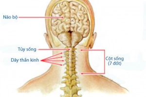 Phương pháp điều trị dập tủy sống cổ?