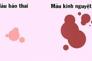 Ra máu báo thai có đau bụng không?