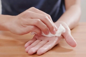 Ra nhiều mồ hôi tay chân điều trị thế nào?