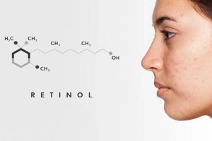 Retinol an toàn khi sử dụng đúng cách