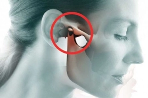 Rối loạn khớp thái dương hàm (TMJ &amp; TMD): Những điều cần biết