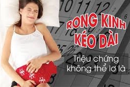 Rong kinh kéo dài