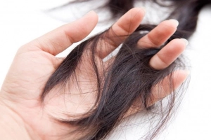 Rụng tóc do thiếu máu thiếu sắt?