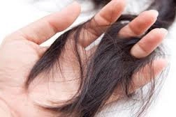 Rụng tóc thành từng mảng lớn kèm yếu tóc có sao không?