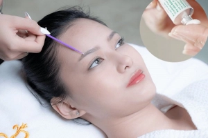 Sau khi xăm mày bao lâu thì bôi thuốc mỡ?